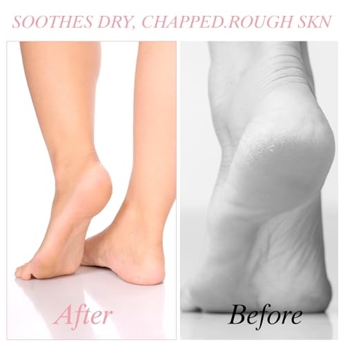 Moisturizing Cotton Socks for Dry Cracked Feet - 4 Pairs Reusable Overnight Foot Treatment