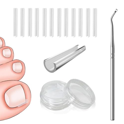 50 Pcs Ingrown Toenail Corrector Strips Kit - Pain Relief Pedicure Tool