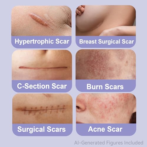 ourmed Medical Grade Silicone Scar Removal Sheets, 1.6" x 6", 5 Pack