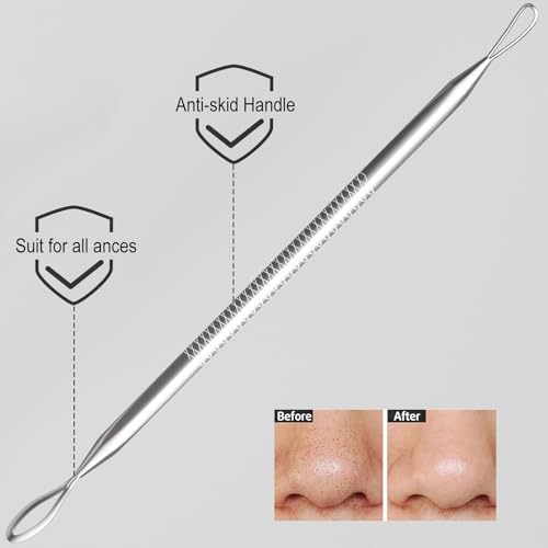 Cbiumpro 6-Piece Blackhead Remover Tool Kit & Pimple Popper Set