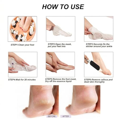 KYAALN Stainless Steel Foot File & Callus Remover Kit with Pads and Masks