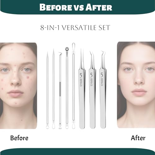 Blackhead Remover Tool Set - 8-Piece Stainless Steel Pimple Extractor Kit