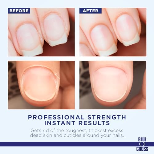 Blue Cross Cuticle Remover Cream 2oz - Moisturizing Nail Softener