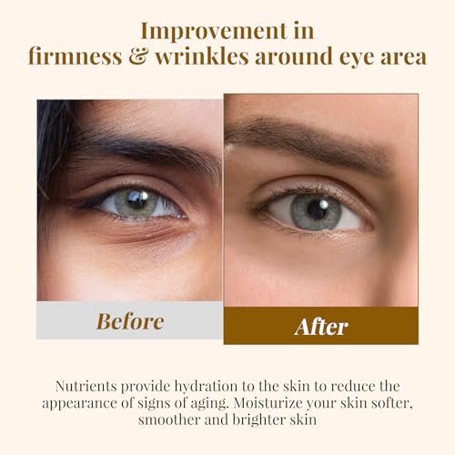EJW Revive Eye Serum with Retinoid - Hydrating & Anti-Aging Under Eye Treatment, 0.5 oz