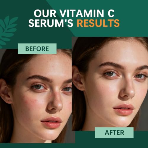 Agenyx Vitamin C Serum for Face with Hyaluronic Acid & Niacinamide