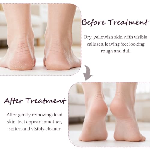 Nano Glass Foot File with Storage Case - Dual-Sided Callus Remover