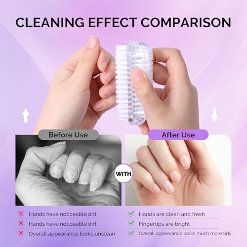 MelodySusie 3-Pack Nail Brush Set for Cleaning Fingernails and Toenails