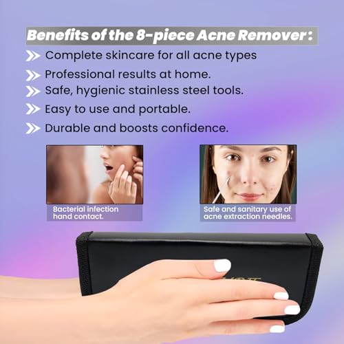 8-Piece Blackhead Remover & Acne Extractor Tool Kit in Stainless Steel