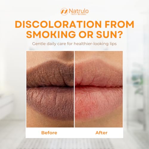 Natrulo Turmeric Lip Balm for Dark Lips – Hydrating Lemon Brightening Chapstick