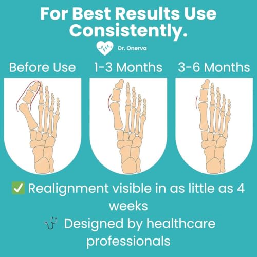 2PC Bunion Corrector for Women & Men ? Toe Straightener Socks for Hallux Valgus, Pain Relief, Non-Slip, Breathable, Day & Night Use, Washable, L/R Foot Set