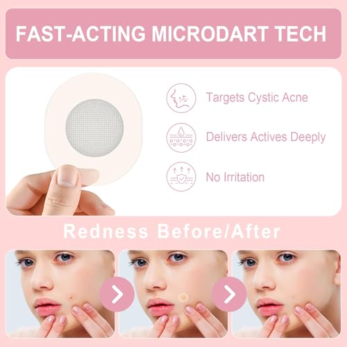 Vathery 3-Step Pimple Patch Kit with Microdart & Hydrocolloid Zit Covers