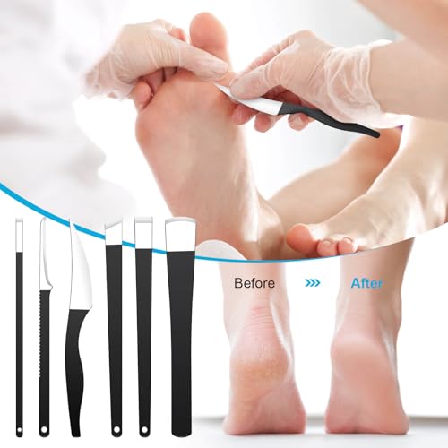 Cakvank 6-Piece Professional Pedicure Knife Set & Ingrown Toenail Removal Kit with Storage Case