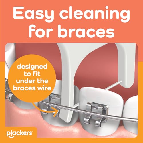 Plackers OrthoPick Dental Floss Picks for Braces, 36 Count