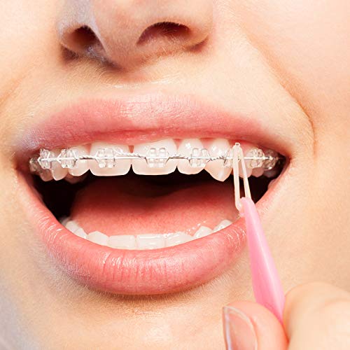 JMU Orthodontic Elastics 3/16 Medium 100 Pack Dental Rubber Bands