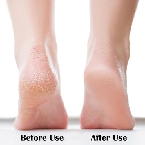 MR LION Nano Glass Foot File & Callus Remover for Dead Skin