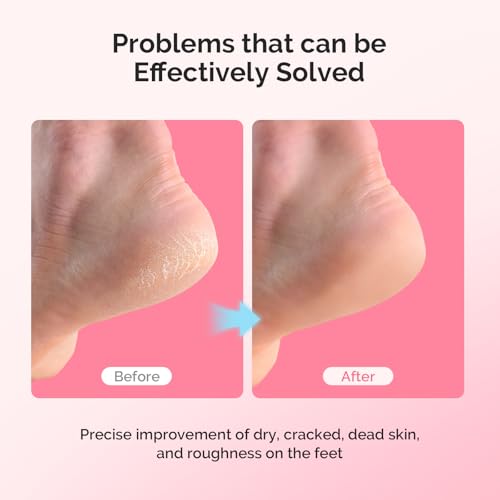 MelodySusie Moisturizing Gel Heel Socks for Cracked Heels, 2 Pairs