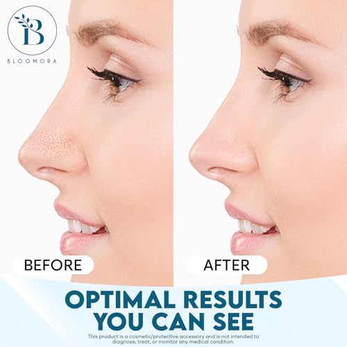 BLOOMORA Nose Pore Strips - Witch Hazel Blackhead Remover (12 Pack)