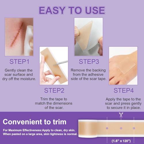 Mitgary Silicone Scar Sheets - Medical Grade Tape for C-Sections & Surgeries