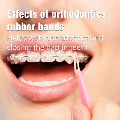 Teckolign Orthodontic Rubber Bands 500 Pack 1/4 Inch Medium 3.5 oz with Placer
