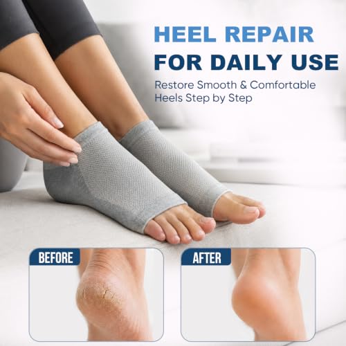OKbutler Moisturizing Heel Socks for Cracked Heels, 2 Pairs Gray