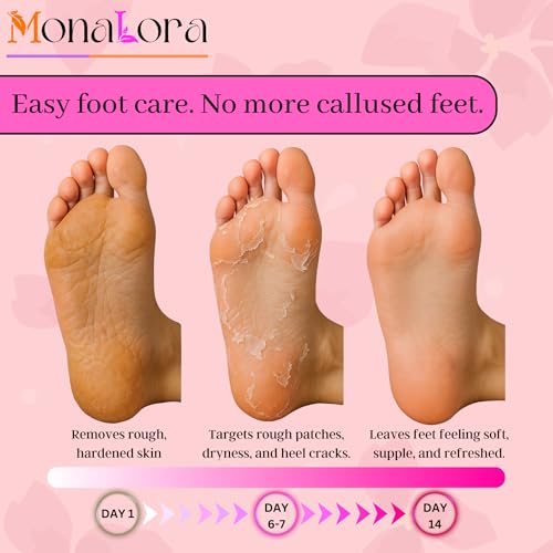 MonaLora Foot Peel Mask 2 Pack - Exfoliating Callus Remover for Dry Feet