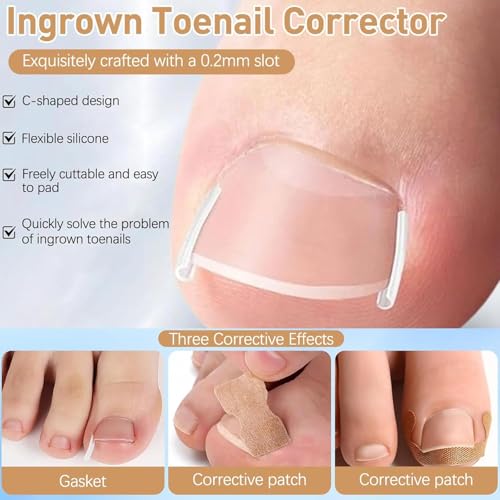 Ingrown Toenail Removal Kit with Correction Patches and Stainless Steel Tools