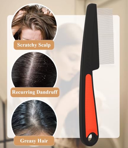 EHBELIF Dandruff Removal Comb, 0.5mm Stainless Steel Fine Tooth Scalp Detox