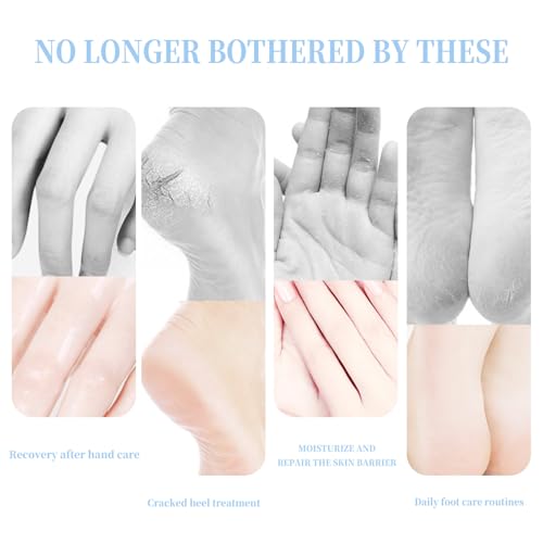 BTYJLEBE Moisturizing Foot Cream Stick for Cracked Heels and Dry Skin (Blue, 40g)