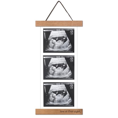 Zyeco Magnetic Ultrasound Photo Frame - Wooden Baby Keepsake Display, Variation 1