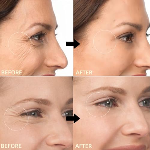 LMDGDS Renewing Retinol Eye Cream & Face Moisturizer - 1.35 oz