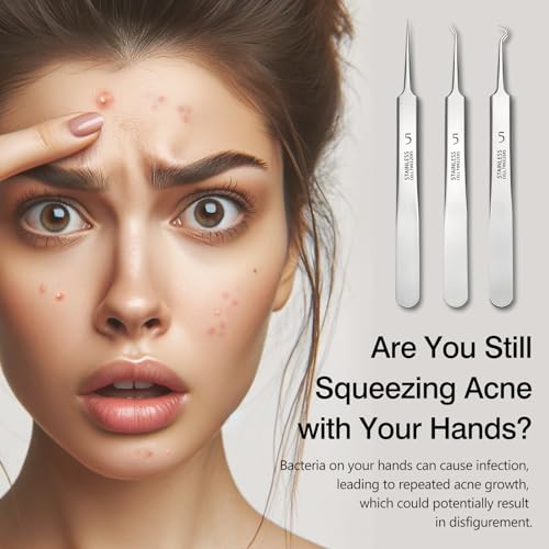 Kootinn 3-Piece Blackhead Removal Tweezers Set - Stainless Steel Pimple Popper
