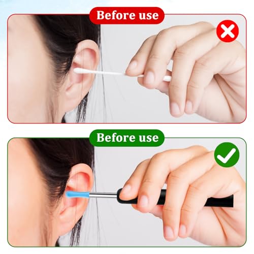 Ptwola Silicone Ear Wax Removal Replacement Tips 30Pcs for Otoscope Camera