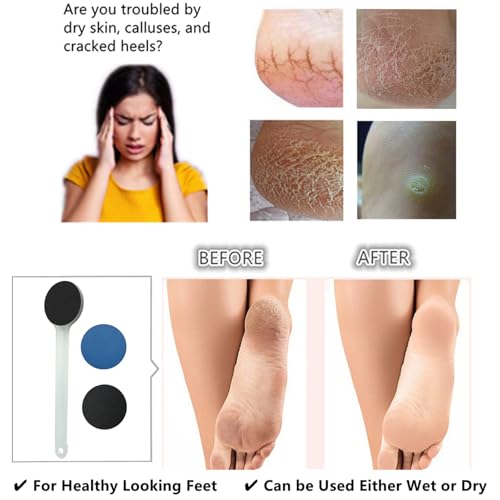 YIOYOODA 14" Long Handle Foot File & Callus Remover - Dual-Sided Pedicure Tool