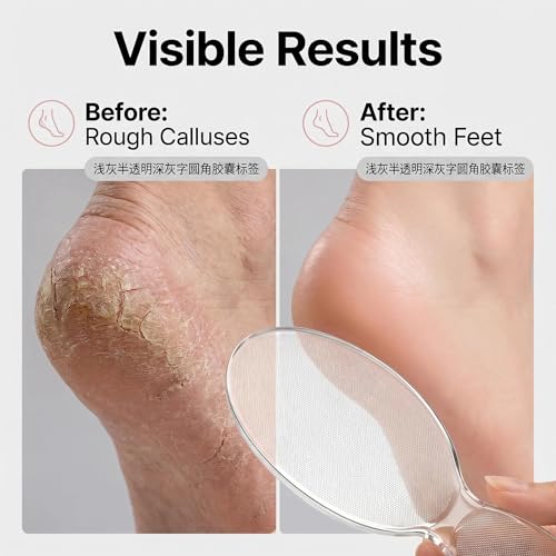Jrotiro Nano Glass Callus Remover & 8-Shaped Foot File Pedicure Tool