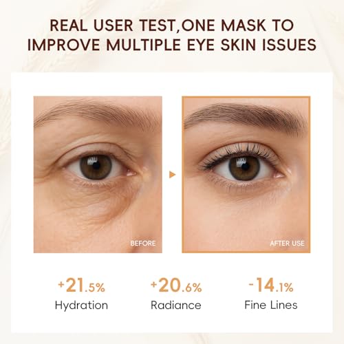 Easilydays 94.4% Triple Rice Ferment Under Eye Patches 5Pcs