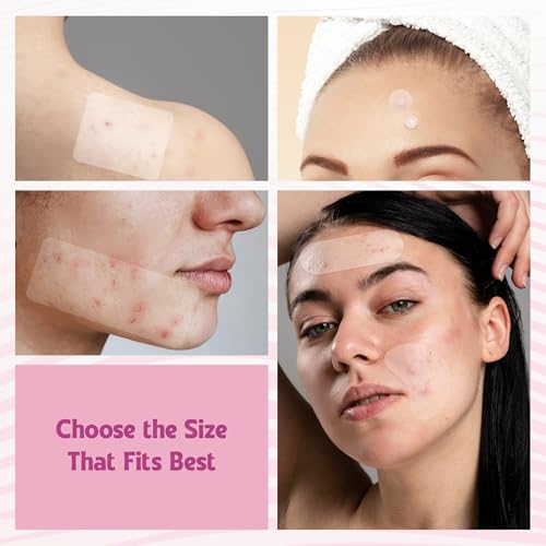 Andlane 344 Pcs Large Hydrocolloid Pimple Patches – 7 Sizes & Shapes for Face and Body