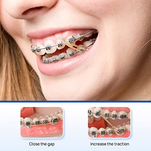 JMU Orthodontic Elastics 1/8 Inch Heavy 300 Pack Latex Rubber Bands