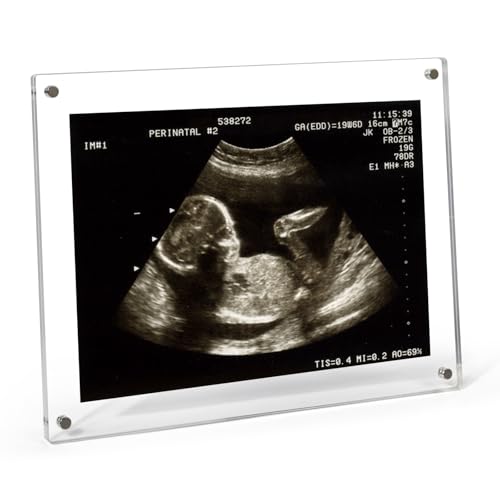 6x8 Magnetic Acrylic Ultrasound Picture Frame - Rectangle Sonogram Keepsake