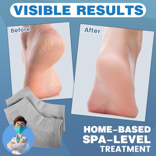 TEAWOO Moisturizing Gel Heel Socks for Cracked Foot Treatment (2 Pairs)