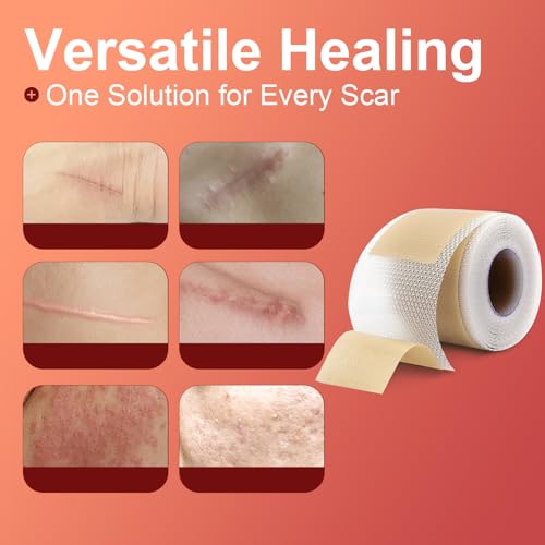Tearich Silicone Scar Sheets - Medical Grade Scar Tape Roll for C-Section, Surgery & Burns