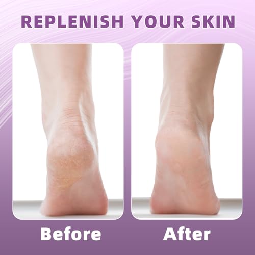 Silicone Gel Heel Socks for Dry Cracked Feet 2 Pairs Moisturizing