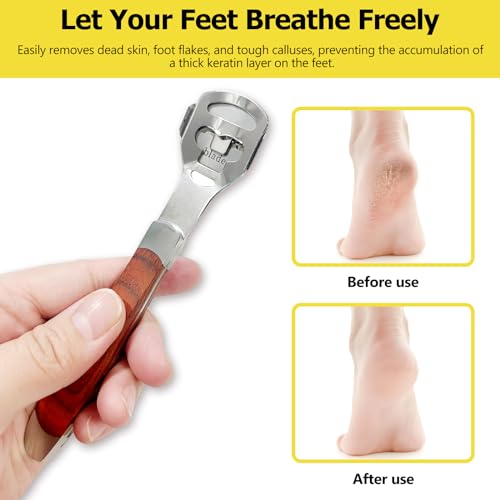 Kootinn Callus Shaver with Wood Handle & 10 Replacement Blades