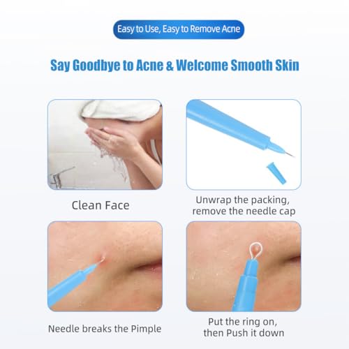 Sterile Disposable Acne Remover Tool 2-Pack Comedone Extractor