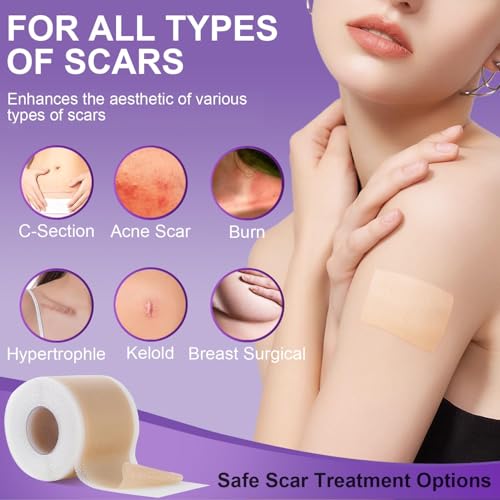 Mitgary Silicone Scar Sheets - Medical Grade Tape for C-Sections & Surgeries