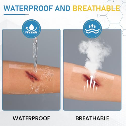 40 Packs Transparent Film Dressing 4" x 4.75", Waterproof Bandages for Wounds, Wound Dressing for Shower or IV Shield, Tattoo Aftercare Bandage, Clear Bandages for Wound Care