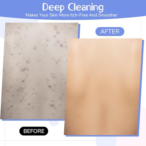 Macuezu 3-Piece Back Scrubber for Shower, Dual-Sided Exfoliating Towel