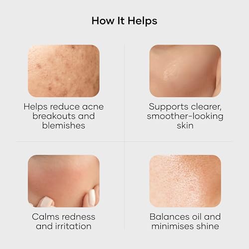 Cureskin Acne Control Gel - Peptide-Powered Pimple Treatment & Blemish Clear