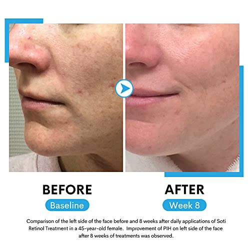 Soti Retinol Face Serum with Hyaluronic Acid & Niacinamide 30ml