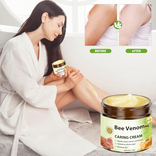NIUYOU Bee Venom Skin Treatment Cream - Natural Moisturizing Blemish Control (2-Pack)