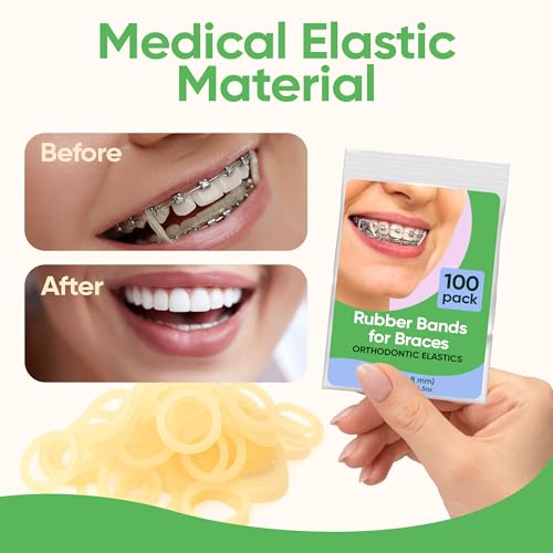 Orthodontic Rubber Bands 1/4 Inch Heavy 4.5 oz with Placer 100 Pack